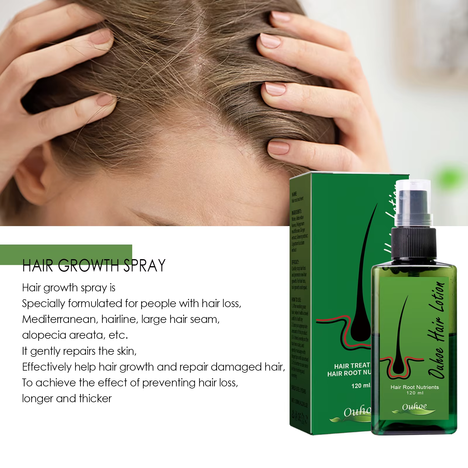 Hair Growth Spray Anti Hair Lo - Root Stimulator Liquid ulasan dan harga