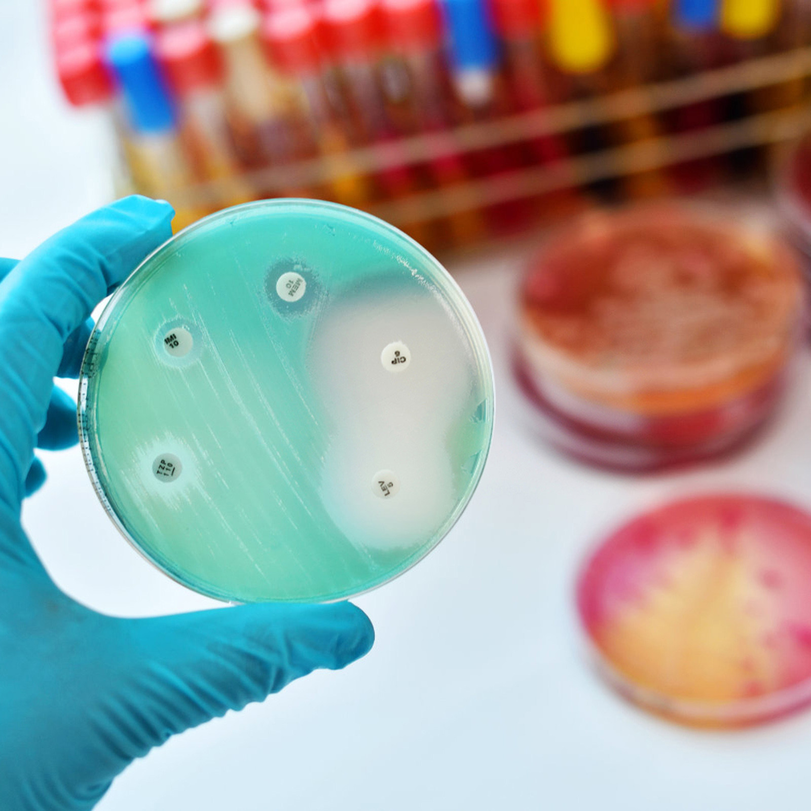 30Pcs Petri Dishes Plastic Cle - Agar Tissue Culture ulasan dan harga